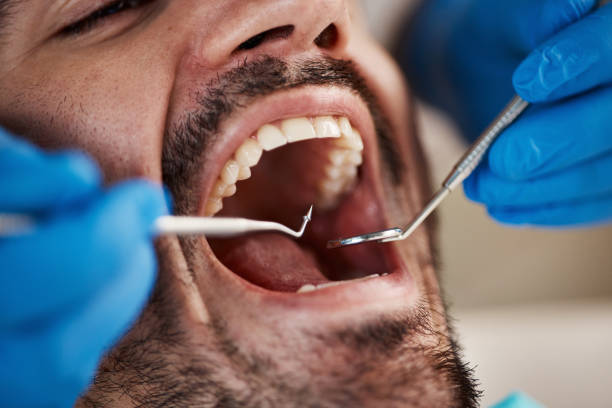 Best Emergency Treatment for Oral Infections in Kinsley, KS